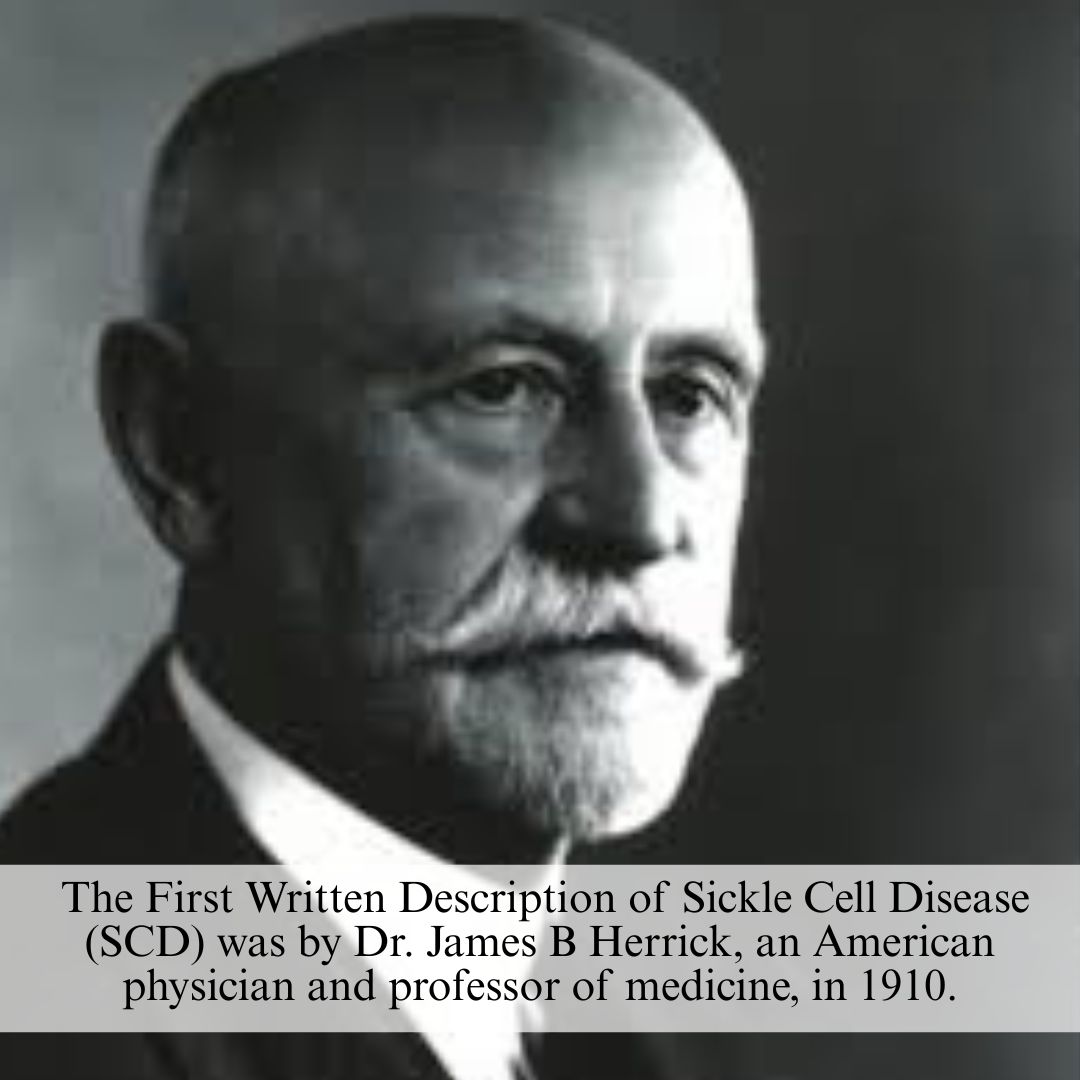 Rewriting the Future of Sickle Cell Disease:  How Genome Editing Offers New Hope